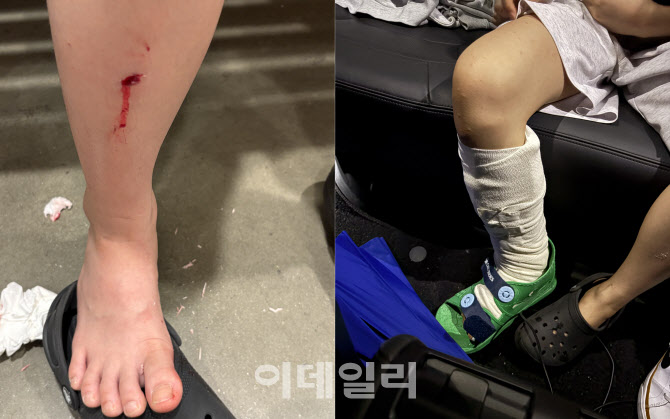 '바닥 물 흥건' 아동 낙상…이케아, 문자로 "10만원 이용권 줄게"