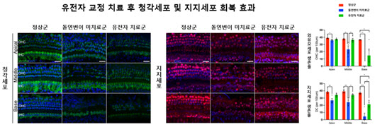 유전성 난청 원인 돌연변이, ‘한 번의 유전자 교정’으로 청력 회복 가능