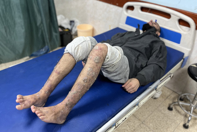 오죽하면 이스라엘 대법원조차…“팔레스타인 수감자 굶기지 마라”