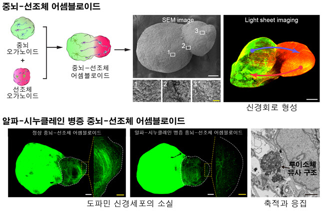 ‘파킨슨병 병리 재현하는 인간 뇌 어셈블로이드’ 개발