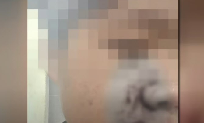 학폭 막아선 의인 전치 2주..."아동학대 신고당해"