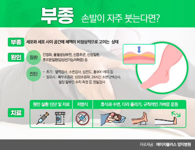 손·발이 자주 붓는다면? 신장·심장 질환 신호일 수도 있어