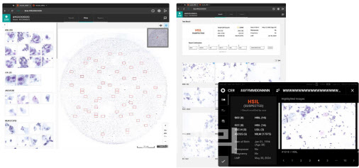 노을 ‘마이랩 CER’ 기술력 우려…선진 시장서 통할까?