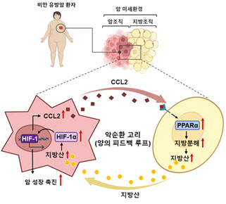 암, 지방 먹고 자란다....비만일수록 진행 속도 빨라