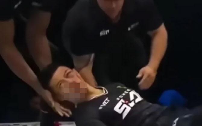 '따귀 대회' 나간 中 무술가, 한 방에 KO "광대뼈 골절"