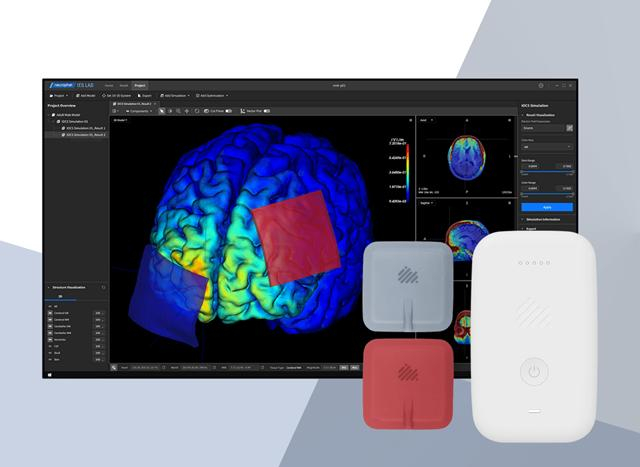 뉴로핏, 삼성서울병원에 ‘개인 맞춤형 tDCS 솔루션’ 국내 첫 공급