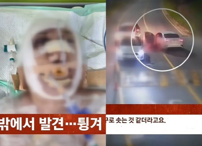 “잠 깨웠냐” 대리기사 매달고 1.5㎞ 질주…CCTV ‘처참’