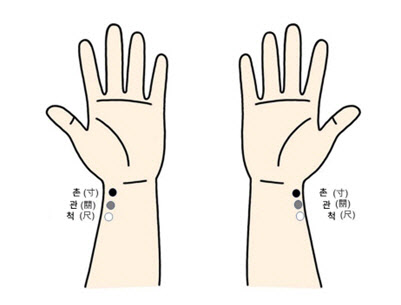 아픈 곳 '반대편'에 침을 놓는 '과학적 근거' 제시