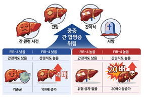 대사이상 지방간 환자, 간경직도 높으면 합병증 위험 높아
