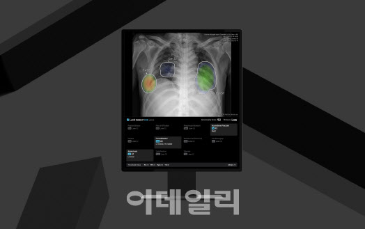 루닛, 원격영상판독 센터에 AI 솔루션 공급…외주 분야로 확장