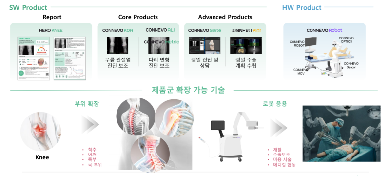"근골격계질환 진단부터 사후 관리까지 국내서 유일하게 가능"