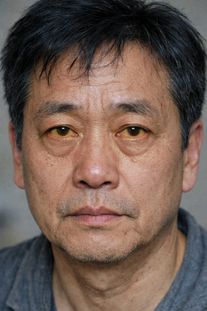술 안 마셔도 생긴다... 간암의 흔한 원인은 술 아닌 이것
