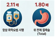 위암 수술 후 담석 발생 위험, 수술 방법에 따라 차이 확인