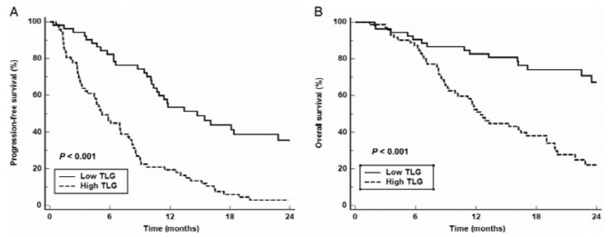 PET/CT 영상 지표로 담도암 환자 치료 효과 예측 확인