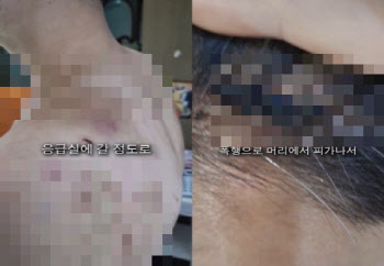 “도망치면 가족 살해”…직원 감금하고 폭행한 부산 중식당