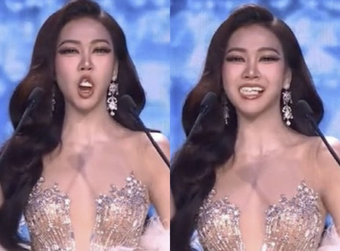 자기소개 중 치아가 ‘툭’…미인대회 참가자에 터진 환호
