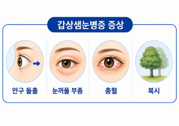 갑상선 기능 정상에도 갑상샘눈병증 증상 지속, 정기 검진 중요