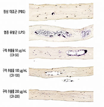 한방 임상 핵심 약재 구척, 뼈 파괴 막는 치료 기전 규명