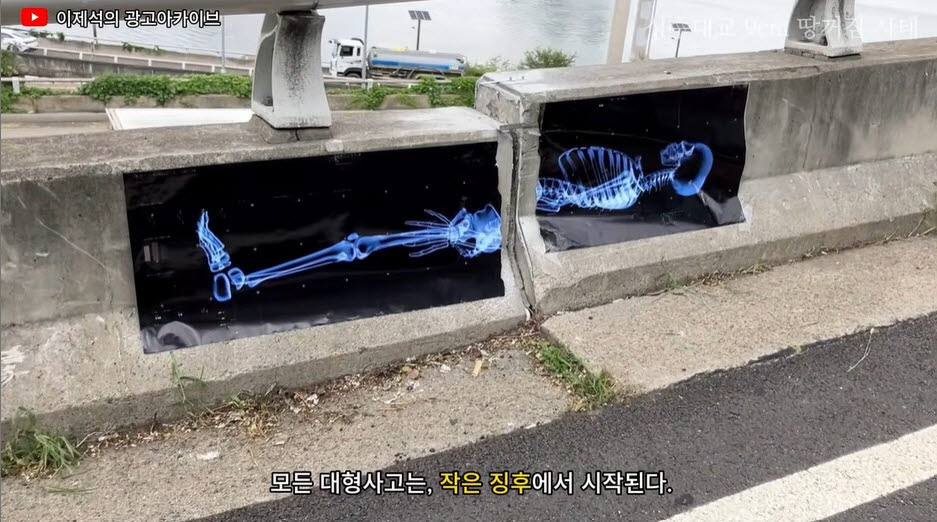 “고작 9cm 가지고 무슨 호들갑?” 성수대교 단차에 엑스레이 사진 붙인 이유