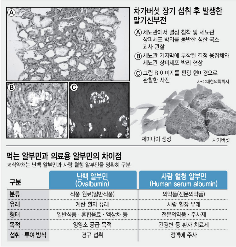 "차가버섯 섭취 후 신장 크게 손상"[안치영의 메디컬와치]