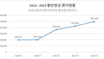 소리없이 실명하는 '황반변성... 5년사이 2.5배 증가해 조심