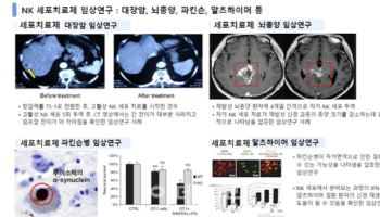 ‘세포치료제 무상 시술’ 前 충북경제자유구역청장 재판行