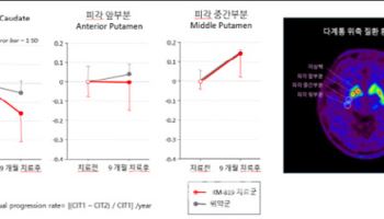 카이노스메드, 美서 5000만달러 규모 투자 유치 유력한 배경은