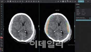 제이엘케이, 두개내출혈 검출 AI 솔루션 美 FDA 허가...도합 5개 승인