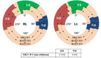 서울대병원, 2차골화중심이 비구 발달에 미치는 영향 확인