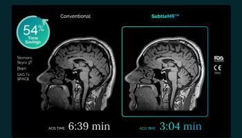 메디칼스탠다드, MRI 가속화 솔루션 시장 다시 진출