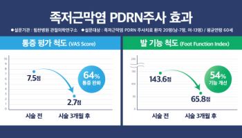 힘찬병원 "발바닥 찌릿한 족저근막염 PDRN치료 '효과'"