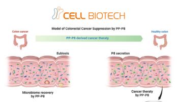 '유산균 강자' 쎌바이오텍 "마이크로바이옴 대장암 신약 임상 시작"