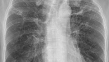 의협 ‘한의사, X-ray 판결 왜곡 해석’ 반박