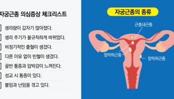 가임기 여성 3명 중 한 명이 겪는 ‘자궁근종’, 방치하지 말아야