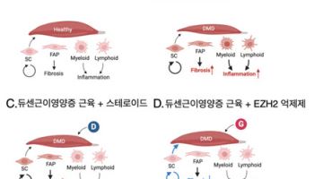 EZH2 억제제로 듀센근이영양증 근육섬유화 감소. 근력향상 효과 입증