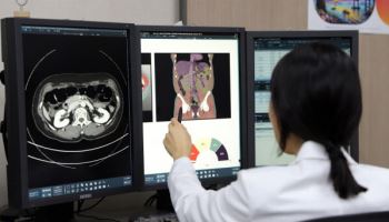 메디컬아이피, 中 북경협화의학원에 AI 의료 솔루션 '딥캐치' 정식 납품
