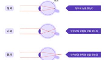 "난이도 높은 ‘원시’도 해결 가능하다"