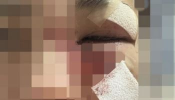 "어머니 제가 뭘 잘못했죠"…16살 어린 여친 때려 '광대뼈 함몰'