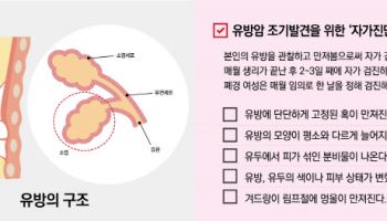 유방암, 꾸준한 관심과 정기검진으로 생존율 높여야