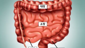 말기암 환자 ‘초음파내시경 유도하 회장결장연결술’ 성공