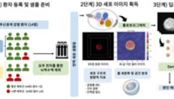 중추신경계 감염 환자, AI로 감염 원인과 예후 예측한다