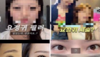 귀도, 안구도 성형한다고?…SNS서 퍼지는 `불편한 유행`