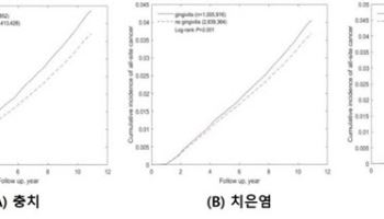 구강질환 있으면 암 사망률도 높아져