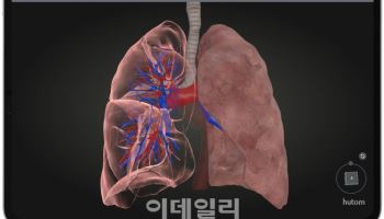 휴톰, 폐암 수술 특화 ‘RUS LUNG’ 출시…"흉부외과 시장 진출"