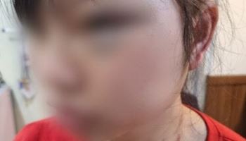 "맞아도 회사 다녀야"...여성 이주노동자 얼굴 걷어찬 40대, 결국
