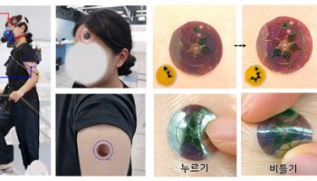 혈액검사 대체?..KAIST, 땀으로 체내 변화 추적 ‘스마트 패치’ 개발