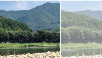 수술 건수 1위 백내장, 언제 수술해야 할까?