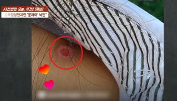 성폭행·담배빵 당한 여고생의 사망…학교도 외면했다