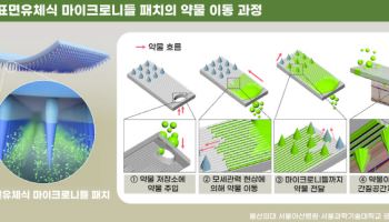 주사 없이 ‘패치 하나로’ 대용량 약물 주입 가능해진다