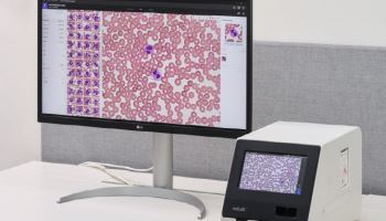 노을, 아산병원과 차세대 AI 기반 혈액분석 솔루션 신제품 성능 결과 공개